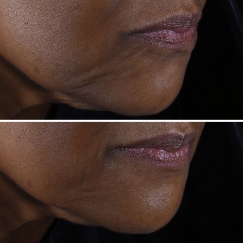 CLINIQUE-Smart Clinical Repair - Crème Liftante Visage + Cou CLINIQUE-Smart Clinical Repair - Crème Liftante Visage + Cou
